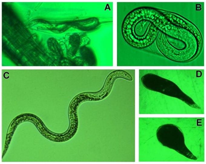 Microscope images of the different life cycle stages of root knot nematode
