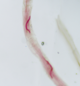 Juveniles in roots stained acid fuchsin microscope image of juvenile PCN in roots